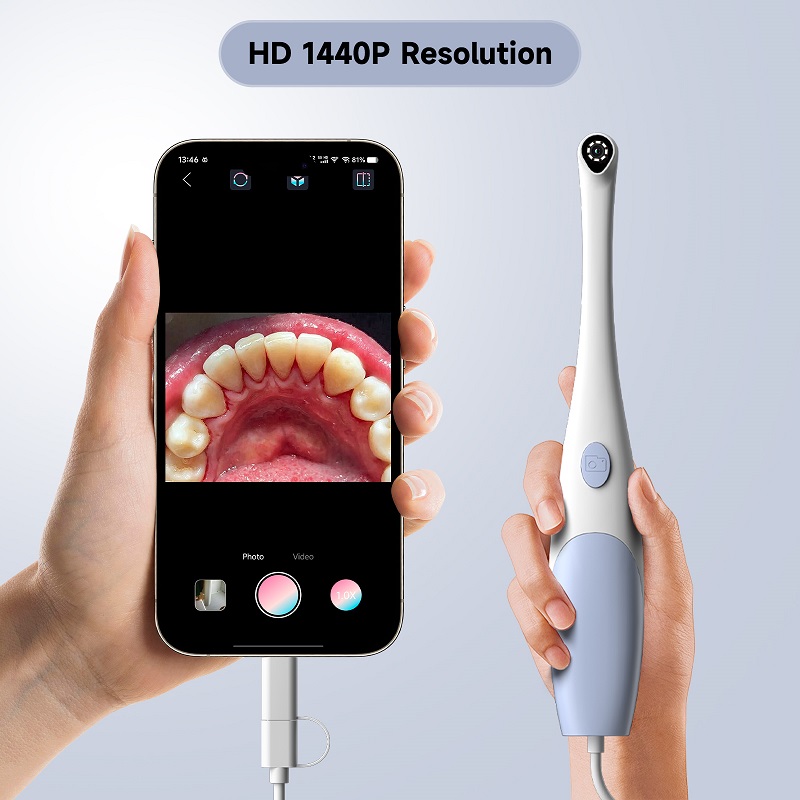 Oral Endoscope Camera 1440P Ph - Photography Lighting Spotlight ulasan dan harga